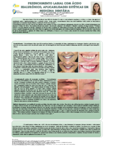 Preenchimento labial com ácido hialurónico, aplicabilidades estéticas em medicina dentária