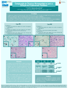 Comparação de Técnicas Histopatológicas para a Deteção da Criptococose Pulmonar