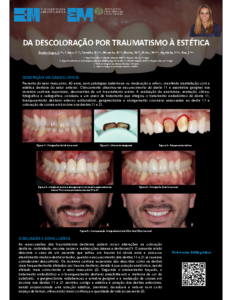 Da descoloração do traumatismo à estética