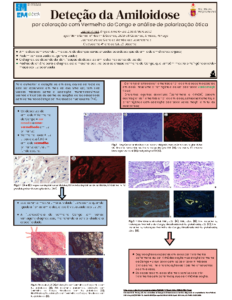 Deteção da Amiloidose através do Vermelho do Congo e Análise Ótica de Polarização