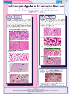 Lesões celulares – Inflamação Aguda Vs Inflamação Crónica