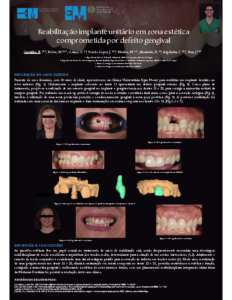 Reabilitação implante unitário em zona estética comprometida por defeito gengival